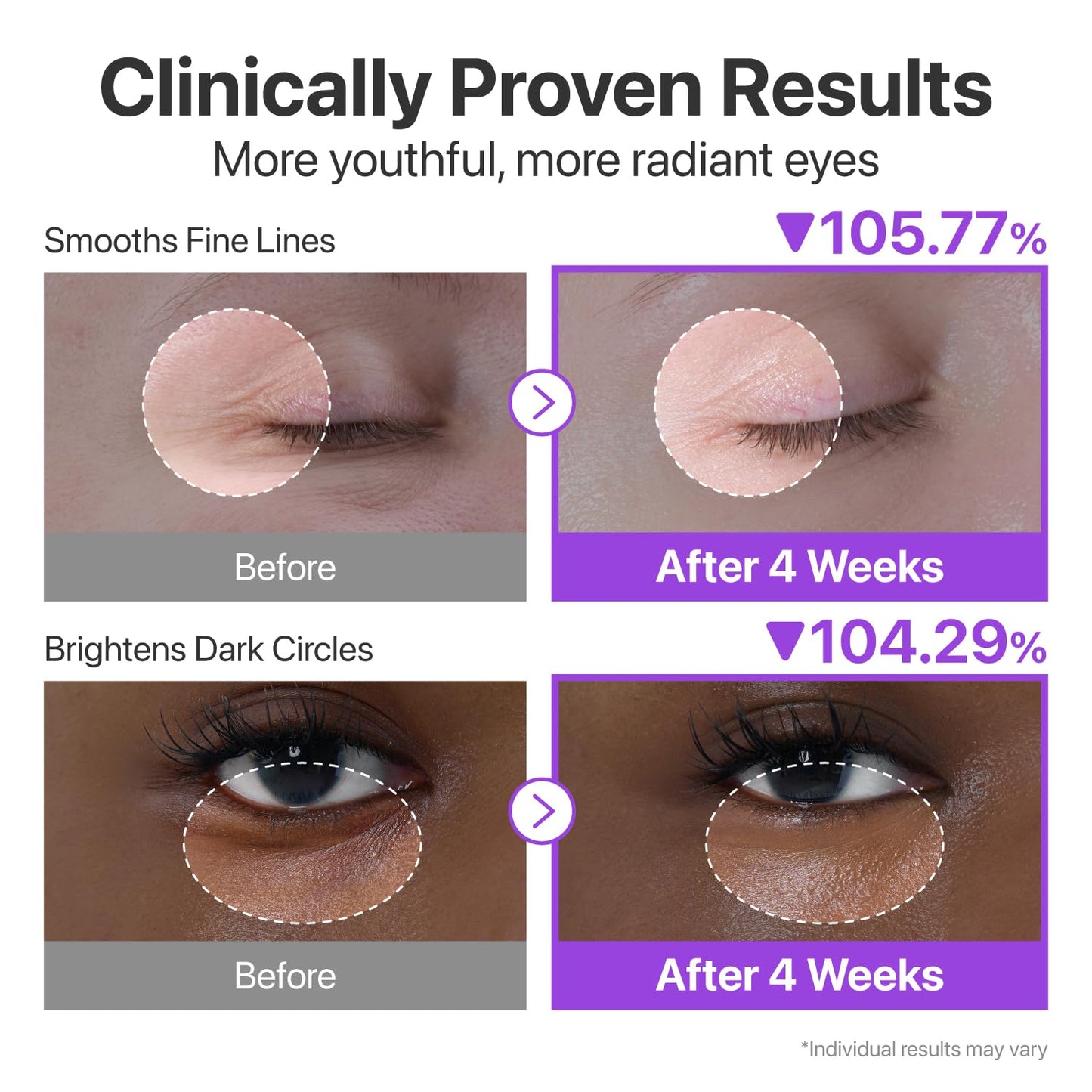 NAD+ Retinol Volumetox Eye Cream | كريم العين NAD+ الريتينول فوليومتوكس