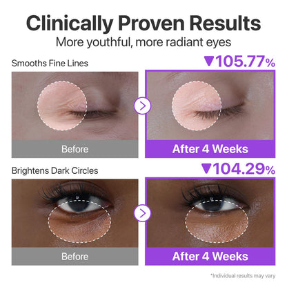 NAD+ Retinol Volumetox Eye Cream | كريم العين NAD+ الريتينول فوليومتوكس